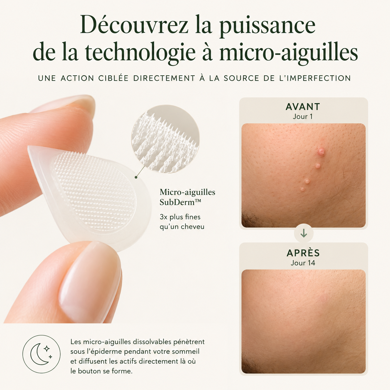 Patch LUMAPEAU — Micro-aiguilles Anti-Imperfections