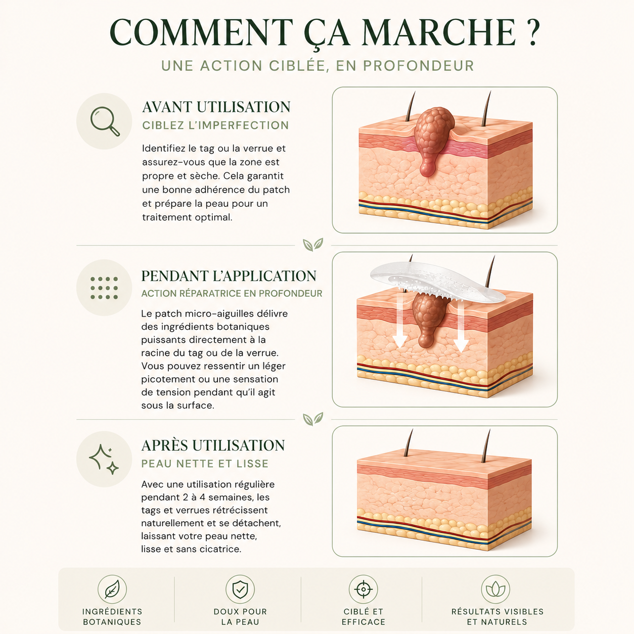 Patch LUMAPEAU — Micro-aiguilles Anti-Imperfections
