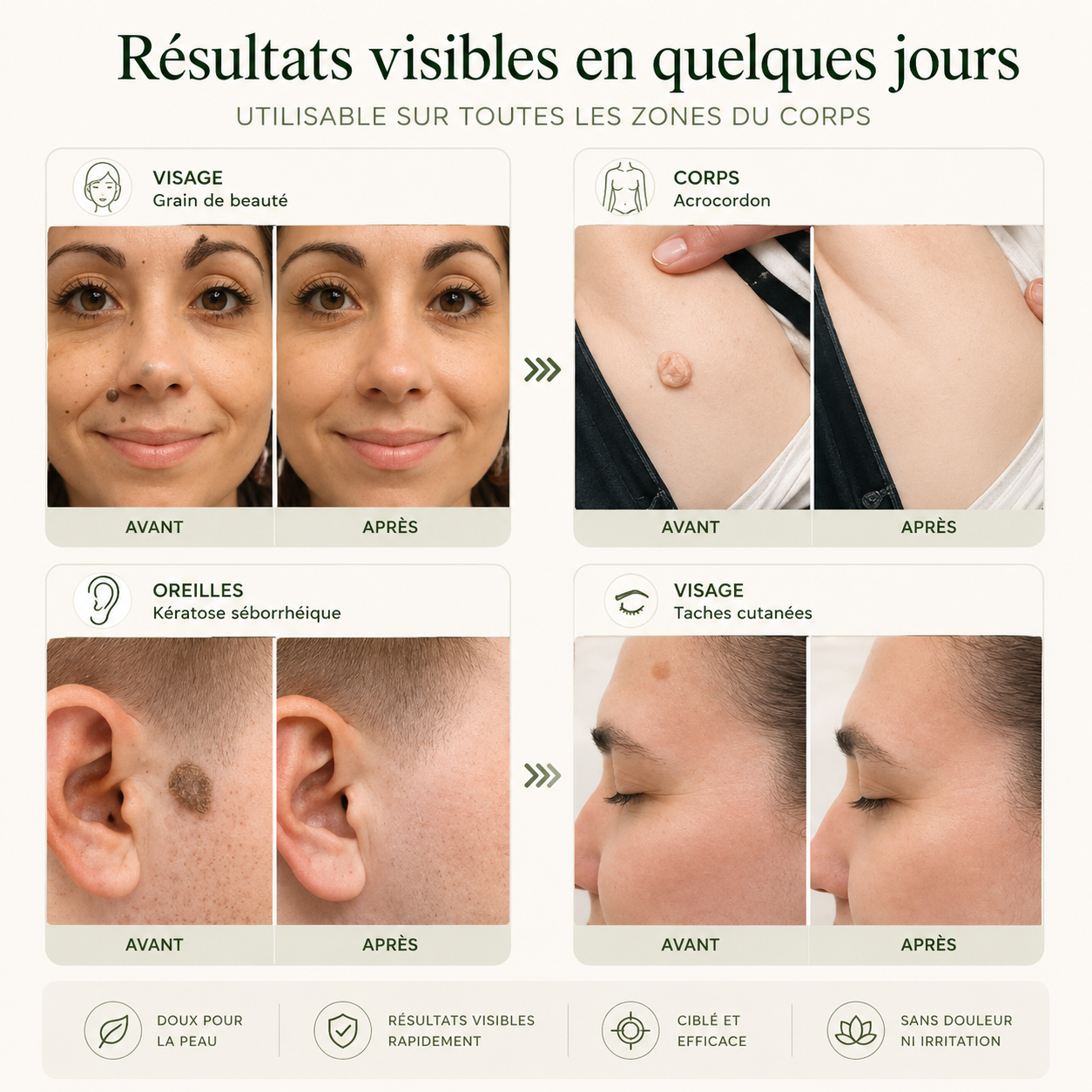 Patch LUMAPEAU — Micro-aiguilles Anti-Imperfections